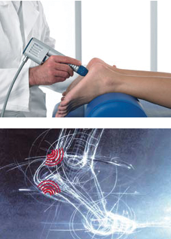 Extracorporeal Pulse Activation Technology (EPAT) Shockwave Therapy